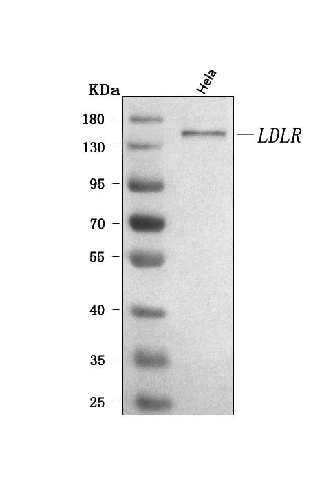 Anti-LDLR Antibody Picoband® Boster Bio