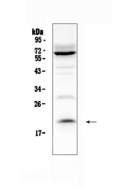 Anti-IL13 Antibody Picoband® Boster Bio