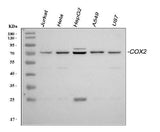 Anti-COX2/Cyclooxygenase 2/PTGS2 Antibody Picoband® Boster Bio