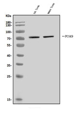 Anti-PCSK9 Antibody Picoband® Boster Bio