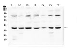 Anti-Rad51 Antibody Picoband® Boster Bio