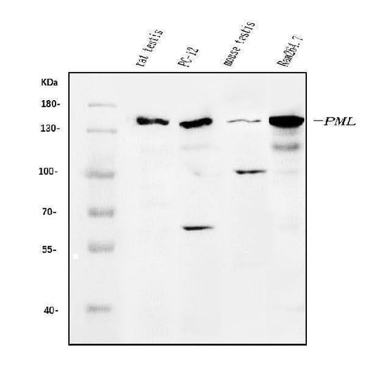 Anti-PML Protein/Pml Antibody Picoband® Boster Bio