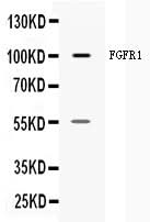 Anti-FGFR1 Antibody Picoband® Boster Bio