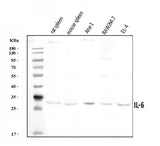 Anti-IL6 Antibody Picoband® Boster Bio