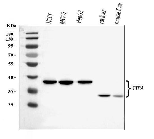 Anti-TTPA/TPP1 Antibody Picoband® Boster Bio