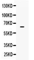Anti-PD-L1/B7-H1/CD274 Antibody Picoband® Boster Bio