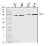 Anti-TRPV1 Antibody Picoband® Boster Bio