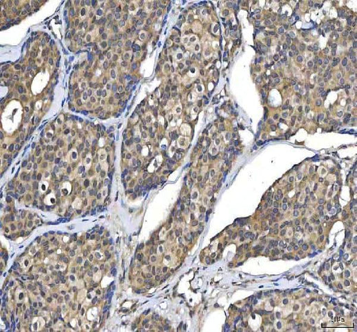 Anti-Huntingtin/HTT Antibody Boster Bio