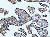 Anti-CD14 Antibody Boster Bio