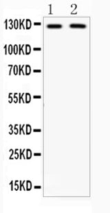 Anti-CD11b/ITGAM Antibody Picoband® Boster Bio