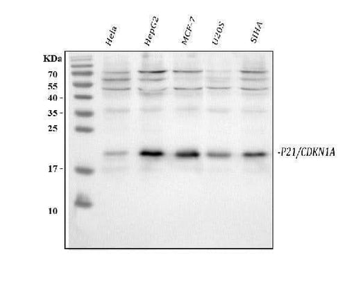 Anti-P21/CDKN1A Antibody Picoband® Boster Bio