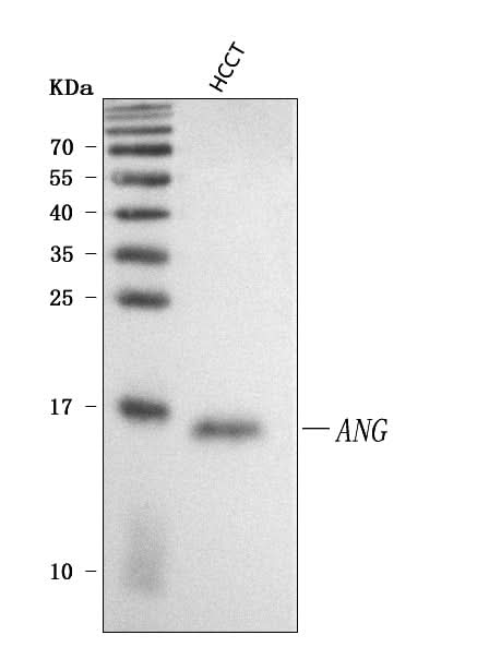 Anti-Angiogenin/ANG Antibody Picoband® Boster Bio