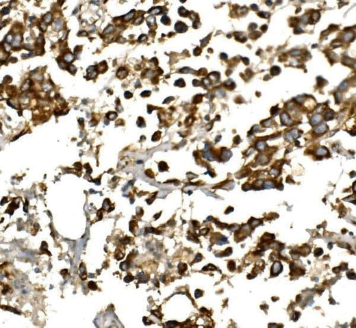Anti-IGF1 Antibody Boster Bio