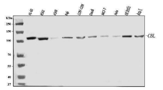 Anti-CBL Antibody Picoband® Boster Bio