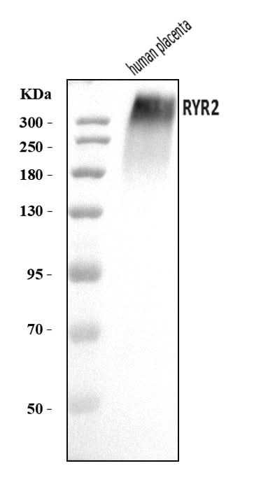 Anti-RYR2 Antibody Picoband® Boster Bio