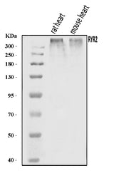 Anti-RYR2 Antibody Picoband® Boster Bio