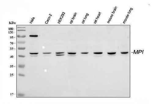 Anti-Mannose Phosphate Isomerase/MPI Antibody Picoband® Boster Bio