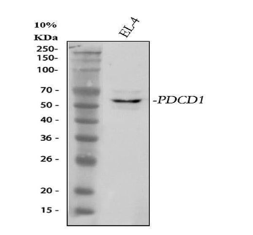 Anti-PD-1/PDCD1 Antibody Picoband® Boster Bio