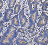 Anti-MUC1 Antibody Boster Bio