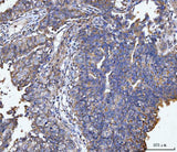 Anti-MUC1 Antibody Boster Bio