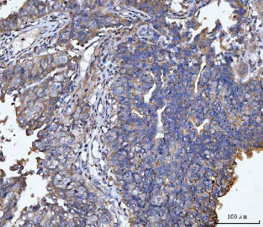 Anti-MUC1 Antibody Boster Bio