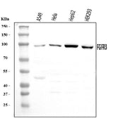 Anti-FGFR3 Antibody Picoband® Boster Bio