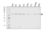 Anti-Vitamin D Receptor/VDR Antibody Picoband® Boster Bio