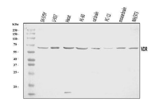Anti-Vitamin D Receptor/VDR Antibody Picoband® Boster Bio