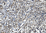 Anti-IL15 Antibody Boster Bio