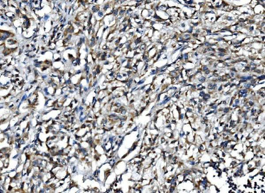 Anti-IL15 Antibody Boster Bio