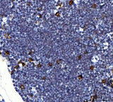 Anti-Il2ra Antibody Boster Bio