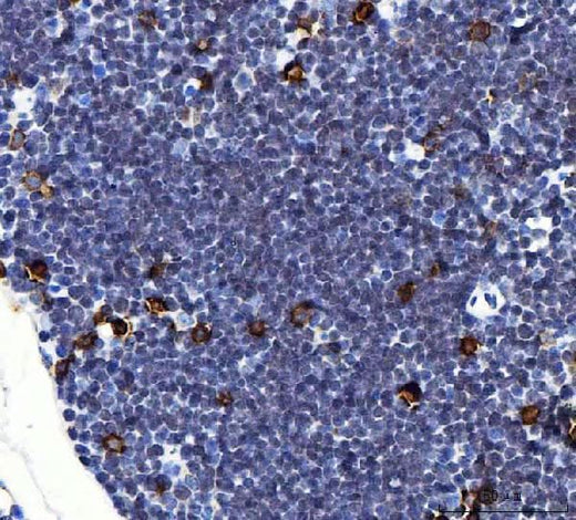 Anti-Il2ra Antibody Boster Bio