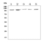 Anti-Aryl hydrocarbon Receptor/Ahr Antibody Picoband® Boster Bio