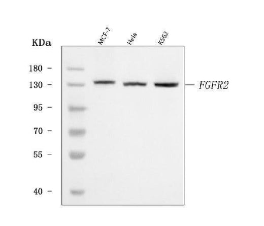 Anti-FGFR2 Antibody Picoband® Boster Bio