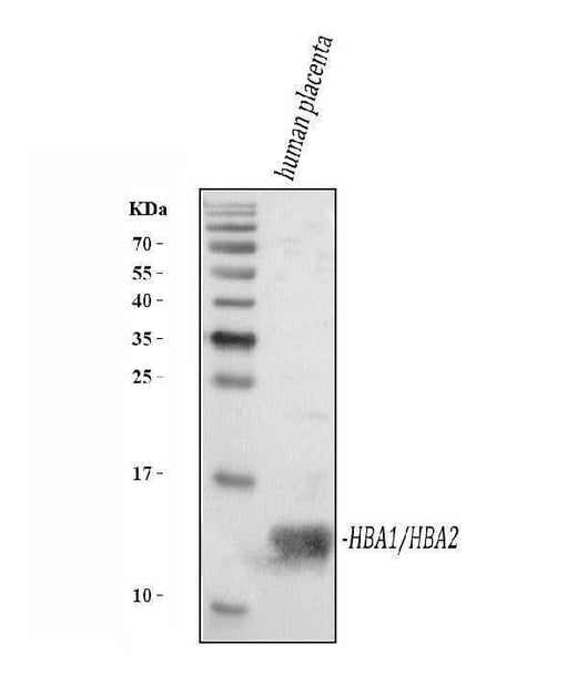 Anti-Hemoglobin/HBA1/HBA2 Antibody Picoband® Boster Bio