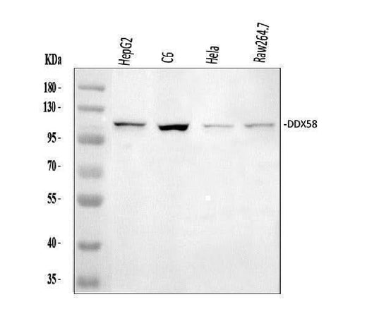 Anti-DDX58 Antibody Picoband® Boster Bio
