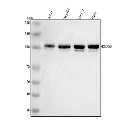 Anti-DDX58/RIG-1 Antibody Picoband® Boster Bio