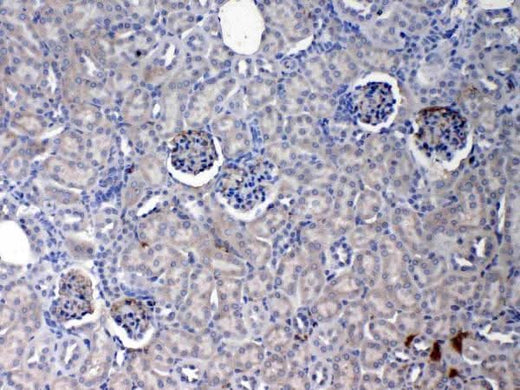 Anti-C Reactive Protein/Crp Antibody Picoband® Boster Bio