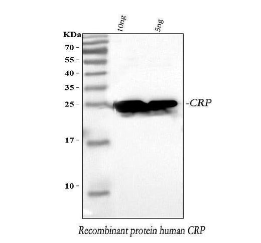 Anti-C Reactive Protein/CRP Antibody Picoband® Boster Bio