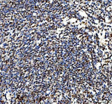 Anti-Ki67/Mki67 Antibody Boster Bio