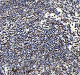 Anti-Ki67/Mki67 Antibody Boster Bio