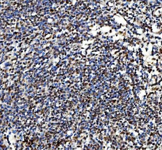 Anti-Ki67/Mki67 Antibody Boster Bio