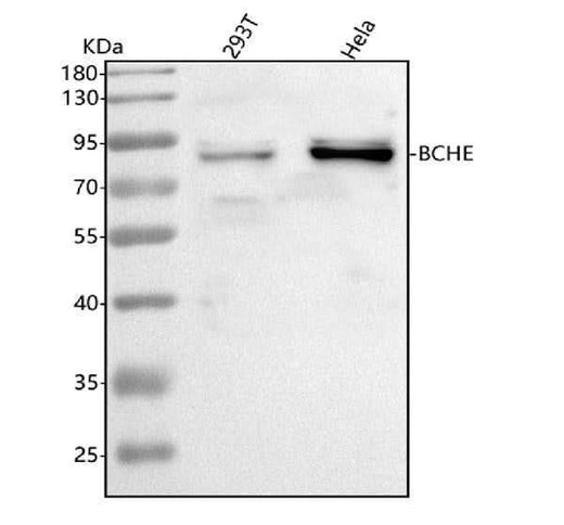 Anti-BCHE Antibody Picoband® Boster Bio