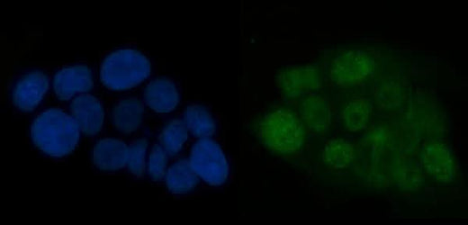 Anti-ATR Antibody Boster Bio