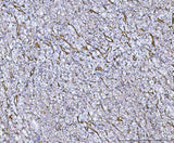 Anti-Von Willebrand Factor/VWF Antibody Boster Bio