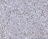 Anti-Von Willebrand Factor/VWF Antibody Boster Bio
