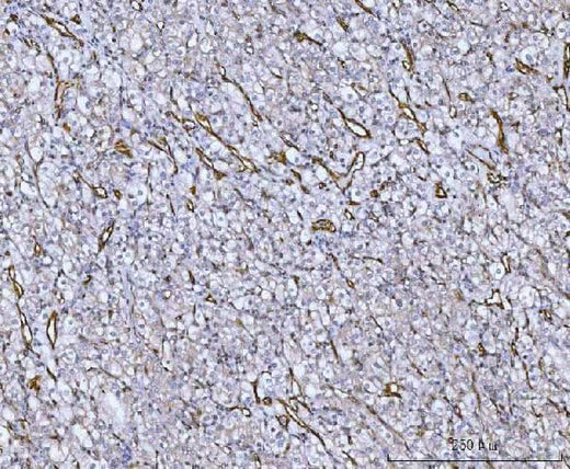 Anti-Von Willebrand Factor/VWF Antibody Boster Bio