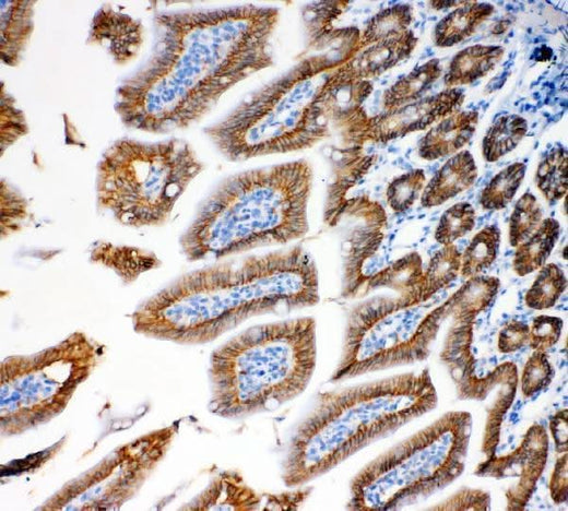 Anti-EpCAM Antibody Boster Bio