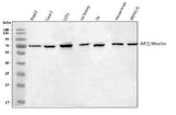 Anti-NF2/Merlin Antibody Picoband® Boster Bio