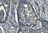Anti-CX3CR1 Antibody Boster Bio